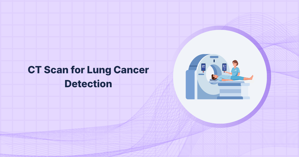 CT Scan for Lung Cancer Detection
