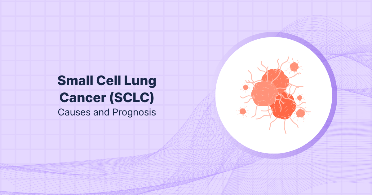 Small Cell Lung Cancer (SCLC): Causes and Prognosis