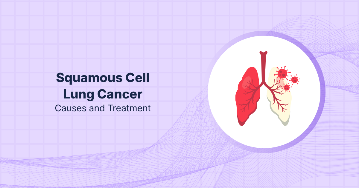 Squamous Cell Lung Cancer: Causes and Treatment