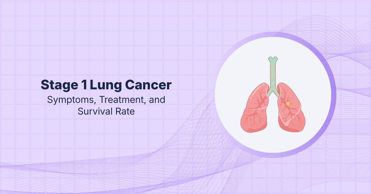 Stage 1 Lung Cancer: Symptoms, Treatment, and Survival Rate
