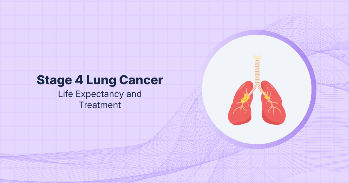 Stage 4 Lung Cancer: Life Expectancy and Treatment